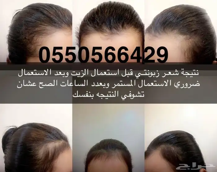 ز ي  ت للشعر طبيعي 100 3