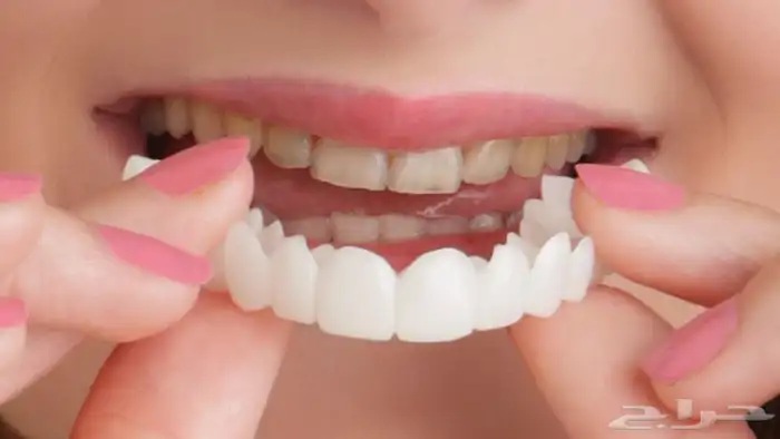عرض أبتسامة هوليوود المتحركة الألمانية 3