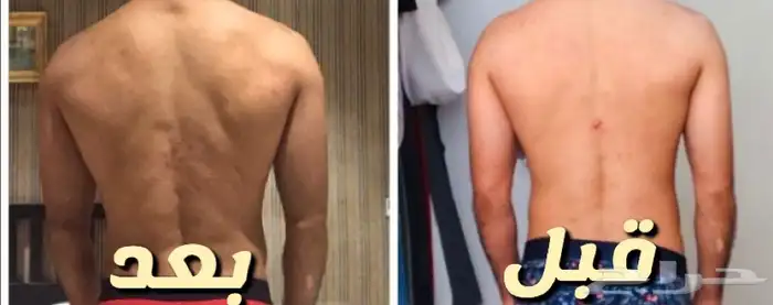 تدريب شخصي وتخسيس وبناء عضلات 24