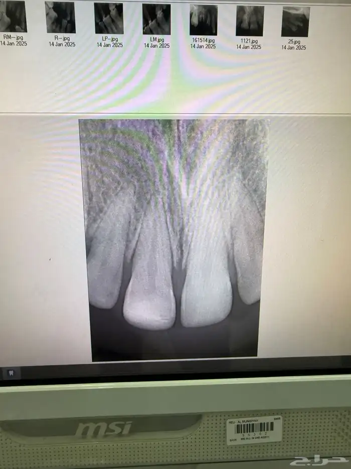 الرياض علاج اسنان مجاني 1