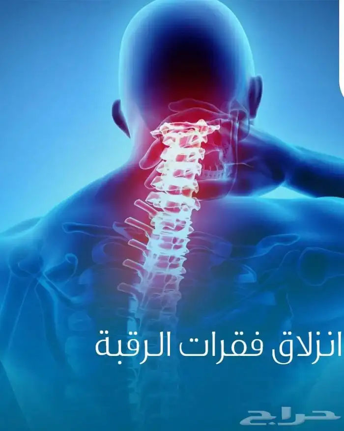 معالج شعبي لي علاج الابهر وعرق النساء والانزلاق الغظروفي 0