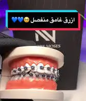 تقويم اسنان زينه عروض اليوم الوطني 0