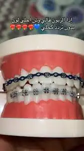 تقويم اسنان زينه عروض اليوم الوطني 1