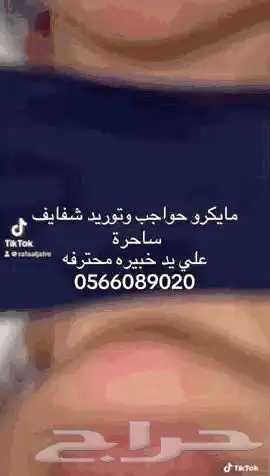 مايكرو بلدينق وشيدينق وتوريد شفايف 1