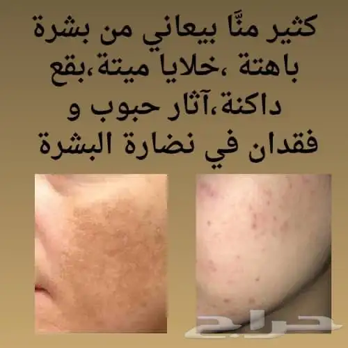 منتجات شركة دكسن 26