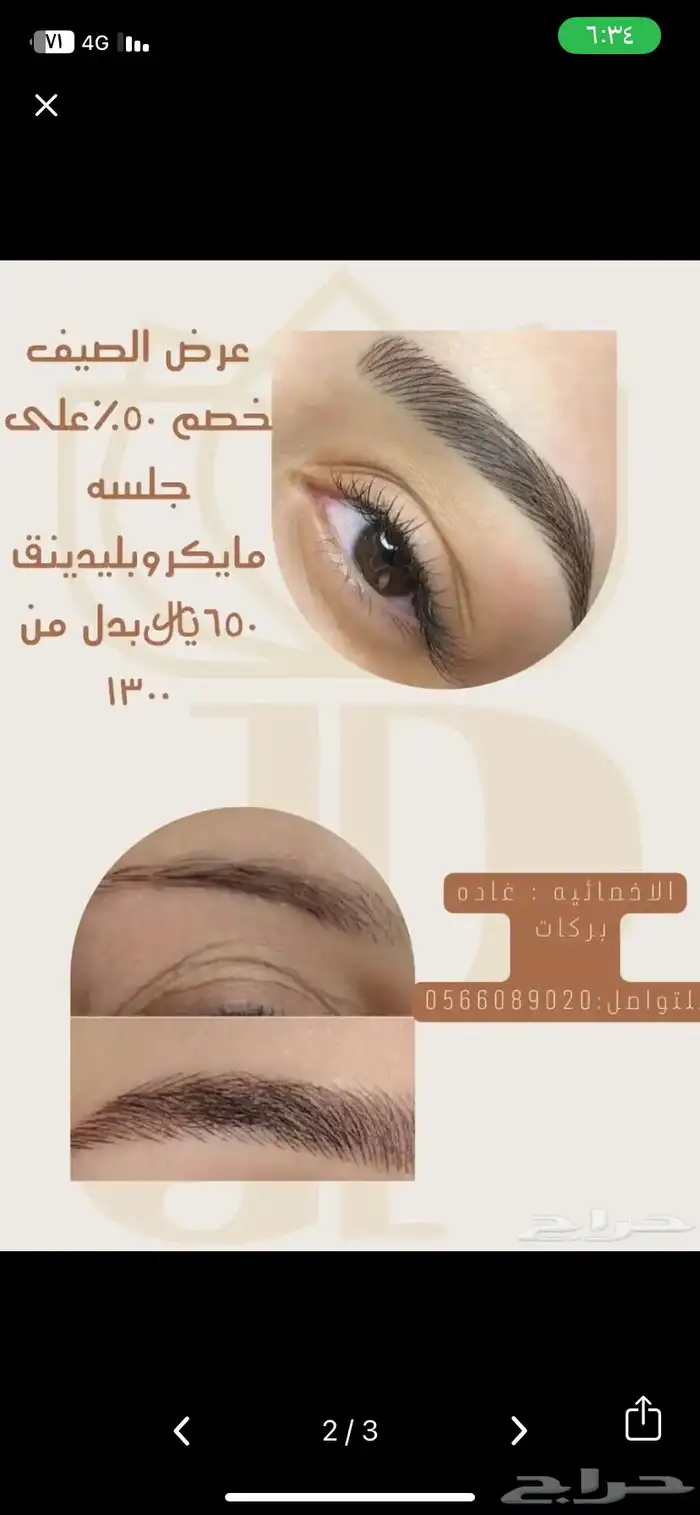 مايكرو بلدينق وشيدينق وتوريد شفايف 2