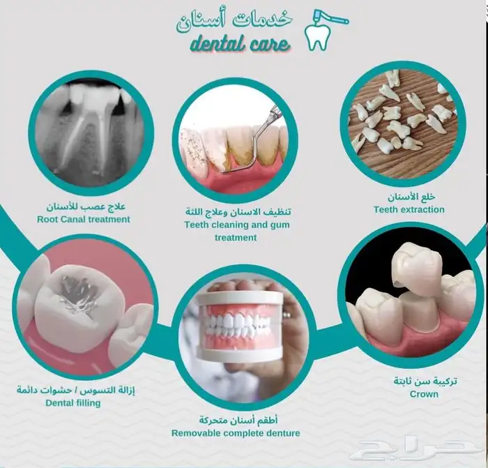 علاج أسنان مجاني 0