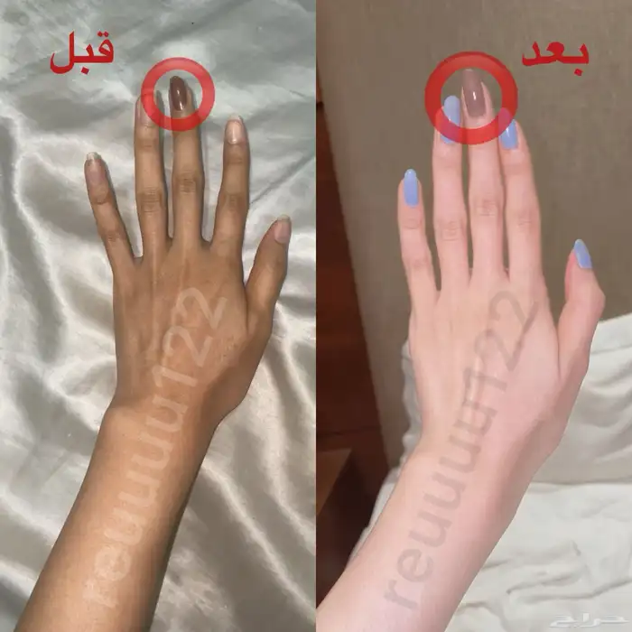 كريم التبيض الفائق 3