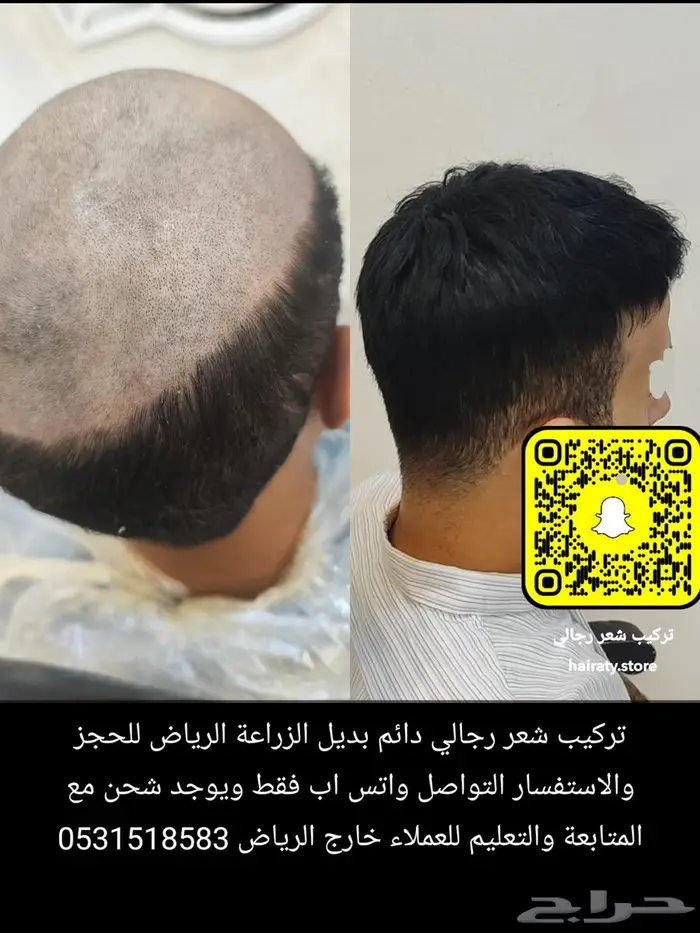 باروكات لاصقه 0