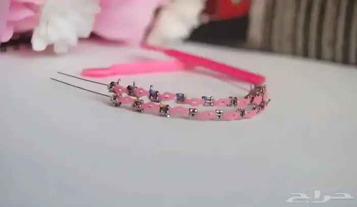 الوان تقويم اسنان 3