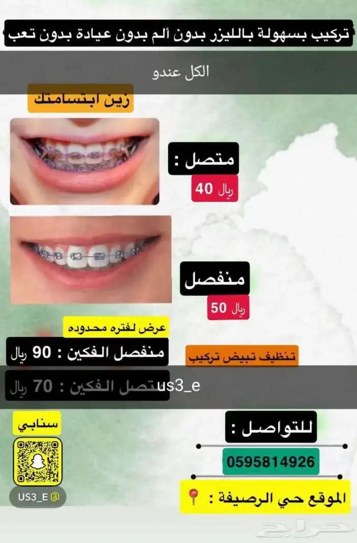 تقويم اسنان مع التركيب 0