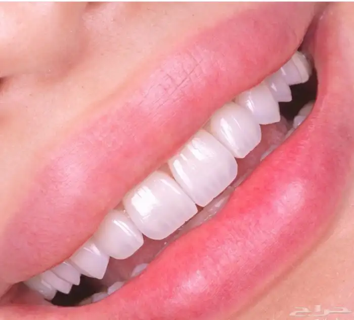 ابتسامه هوليود 3