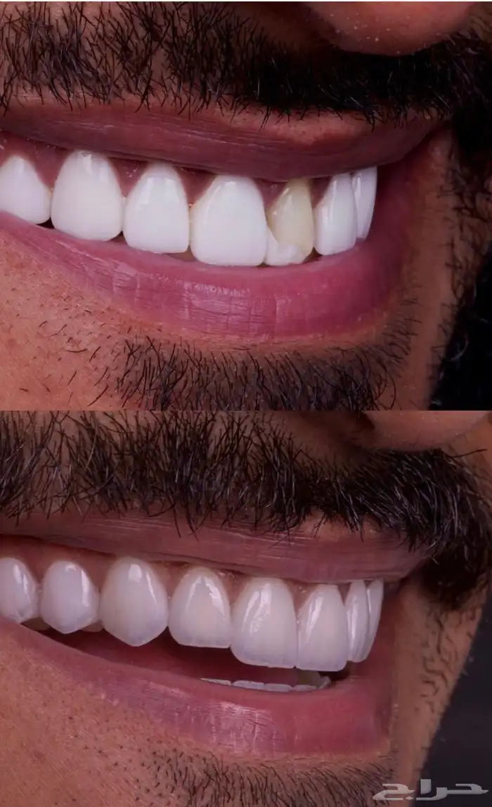 ابتسامه هوليود 2