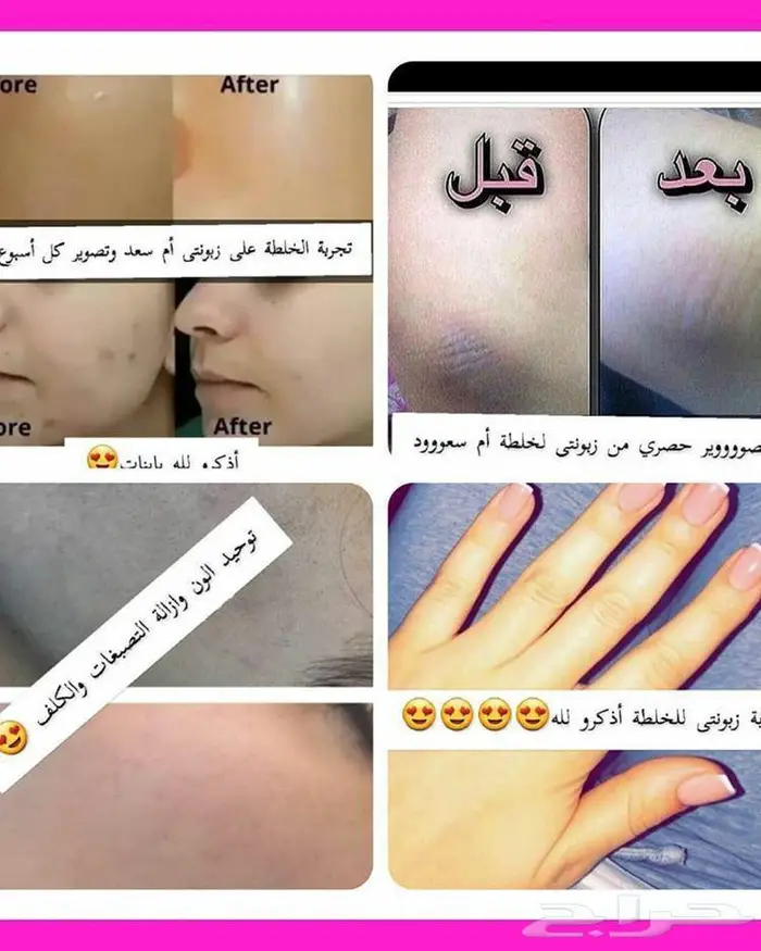لايفوتكم يابنات خلطه تفتيح وتوحيد مضمون 1