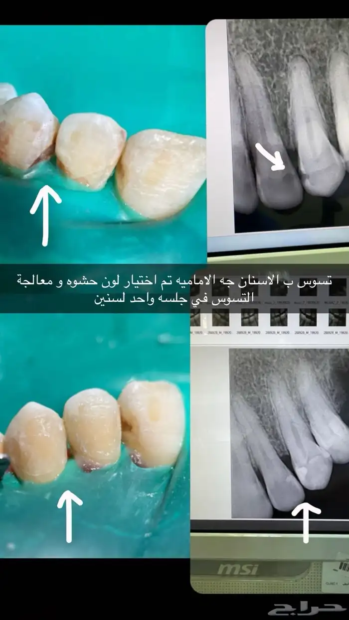 مجاني علاج اسنان الرياض 2