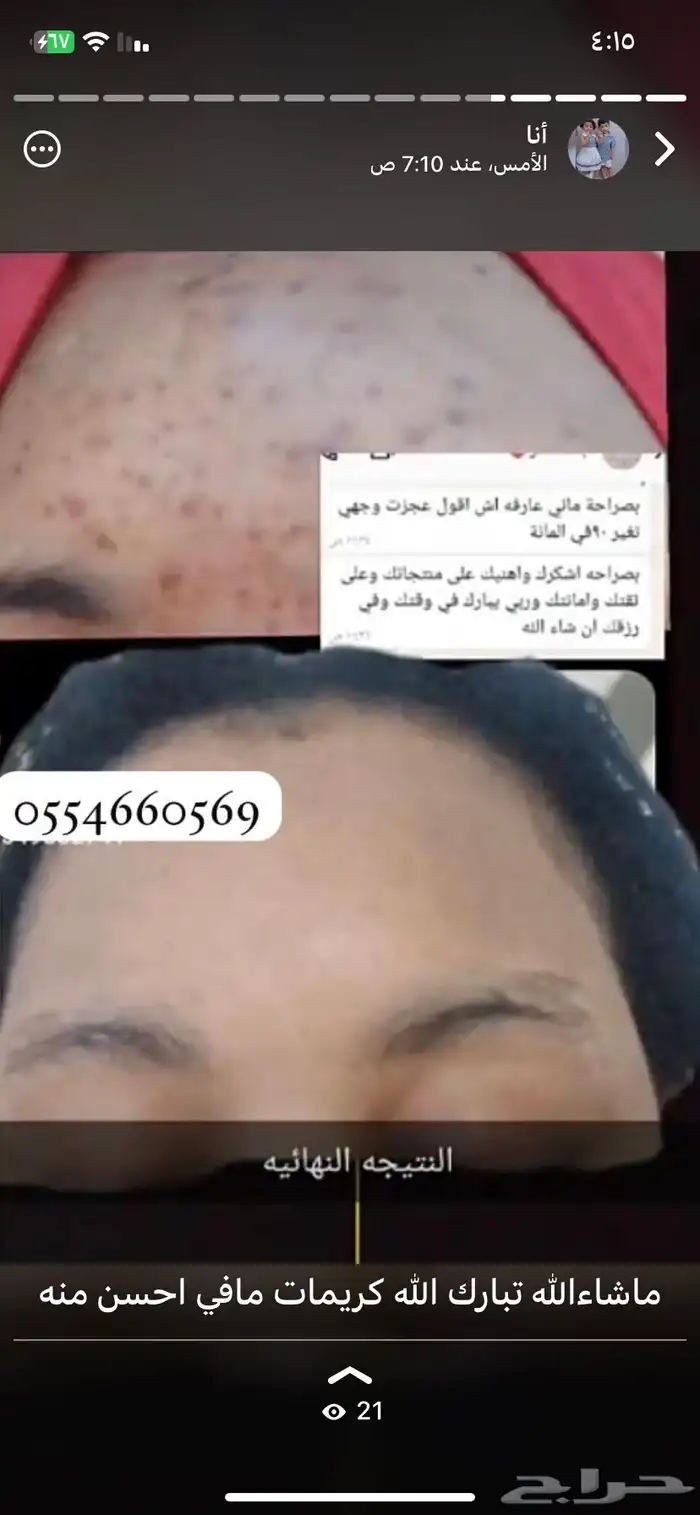 كريمات تفتيح البشرة وتوحيد اللون 2