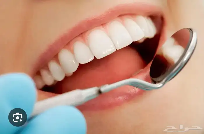 علاج اسنان مجاني بالكامل 0