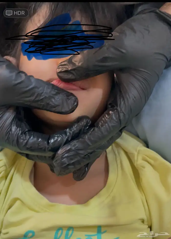اخصائي تخاطب معالجة عامة 0
