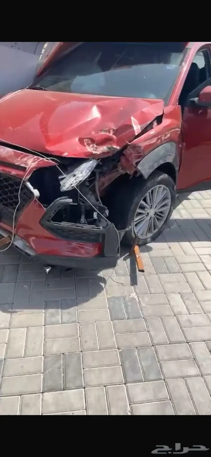 كونا صدمه خفيفه 0