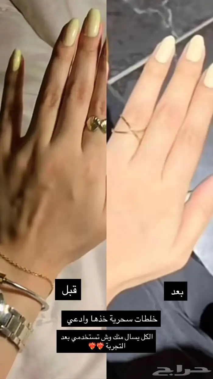 كريمات تبييض في مكة 6