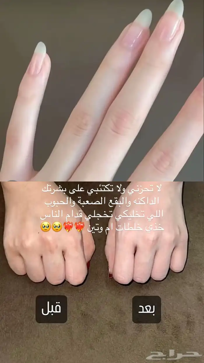 كريمات تبييض في مكة 3