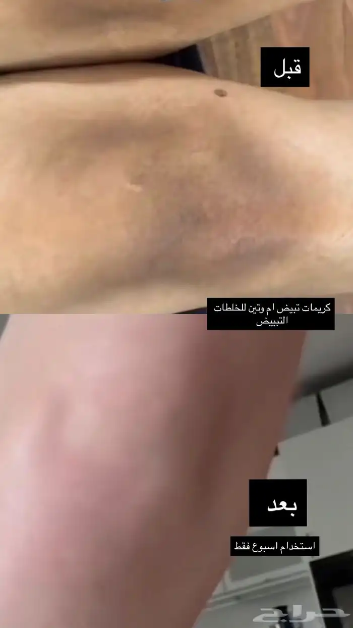 كريمات تبييض في مكة 7
