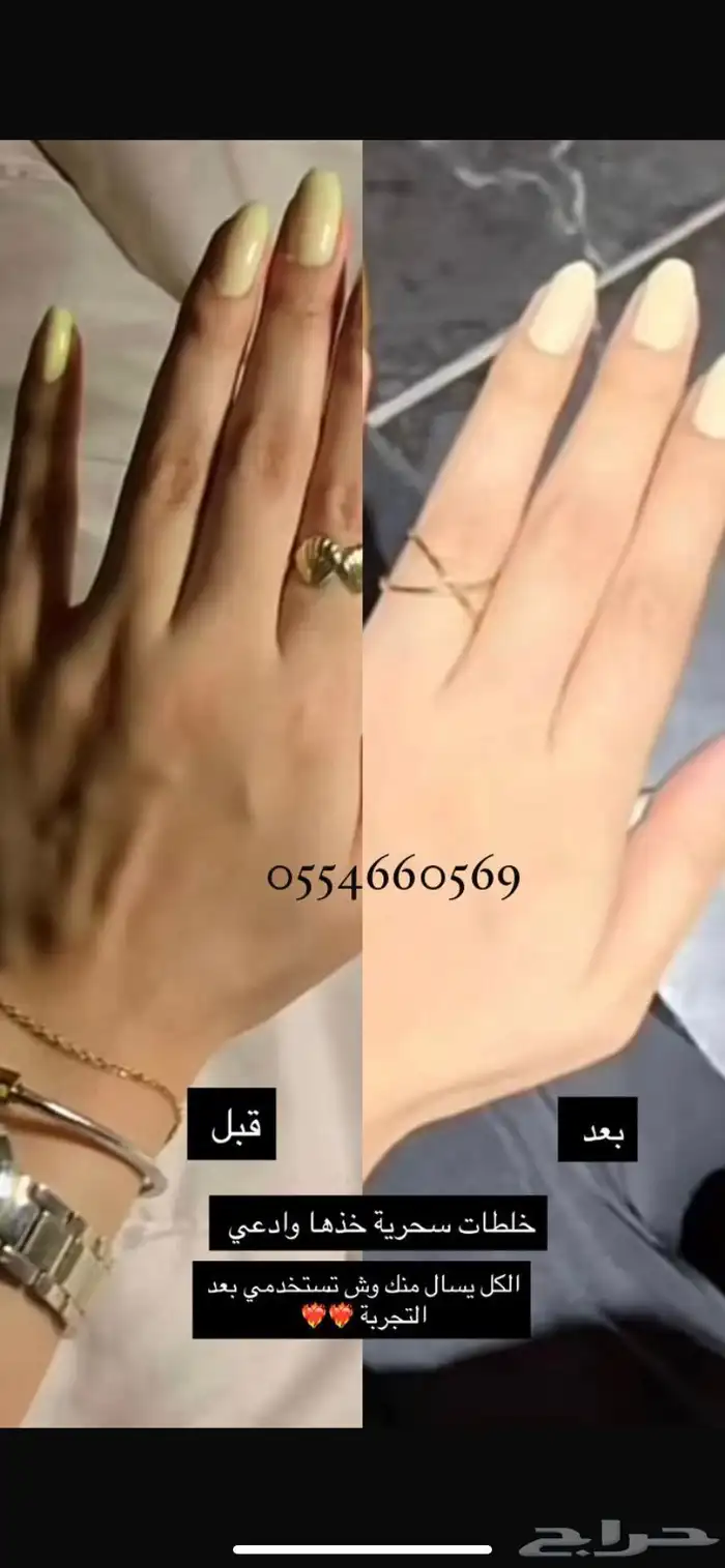 كريمات تبييض في مكة 2