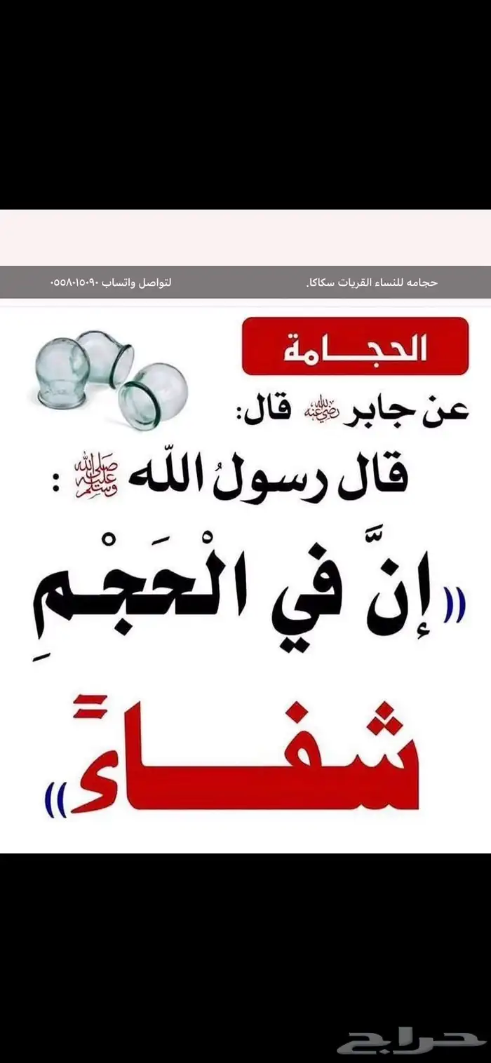 حجامة للنساء 0