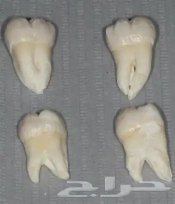 سن عقل 1