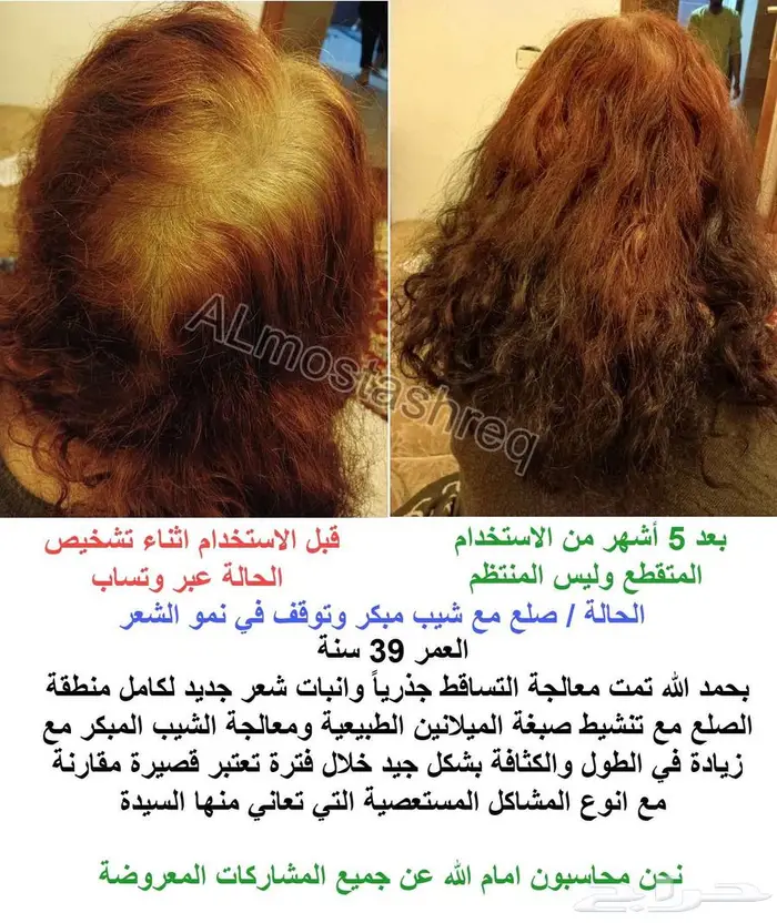 زيت الحشيش الأفغاني الأصلي (ماركة خمس نجوم) 21