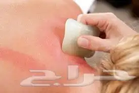 جلسات علاج الابهر والم اسفل الظهر وعرق النسا 2
