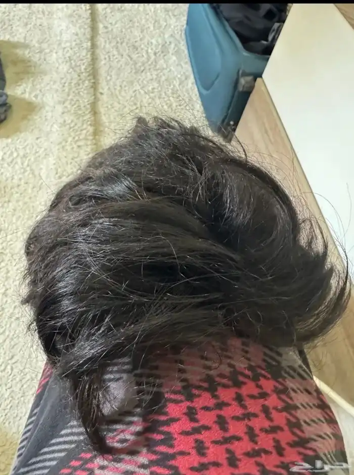 شبكية شعر 0