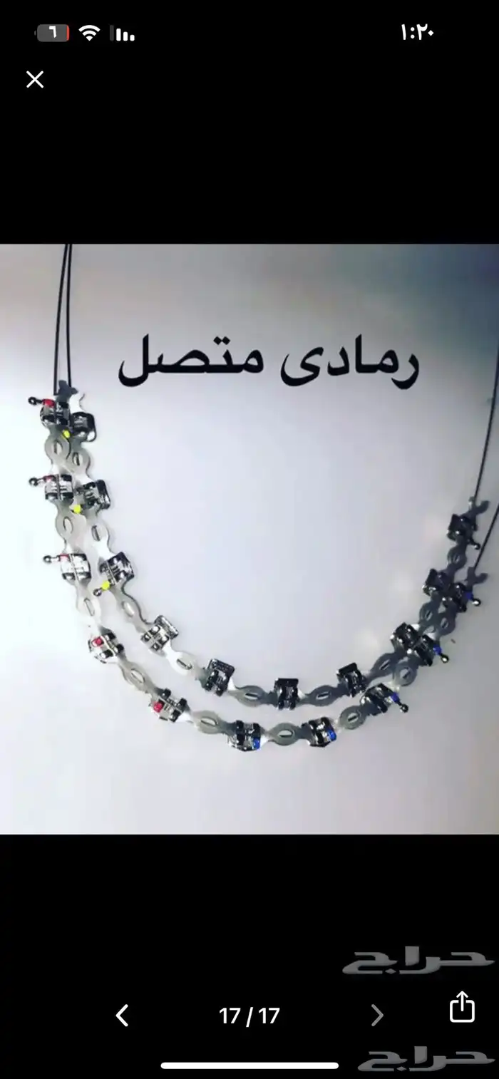 تقويم اسنان زينه 17
