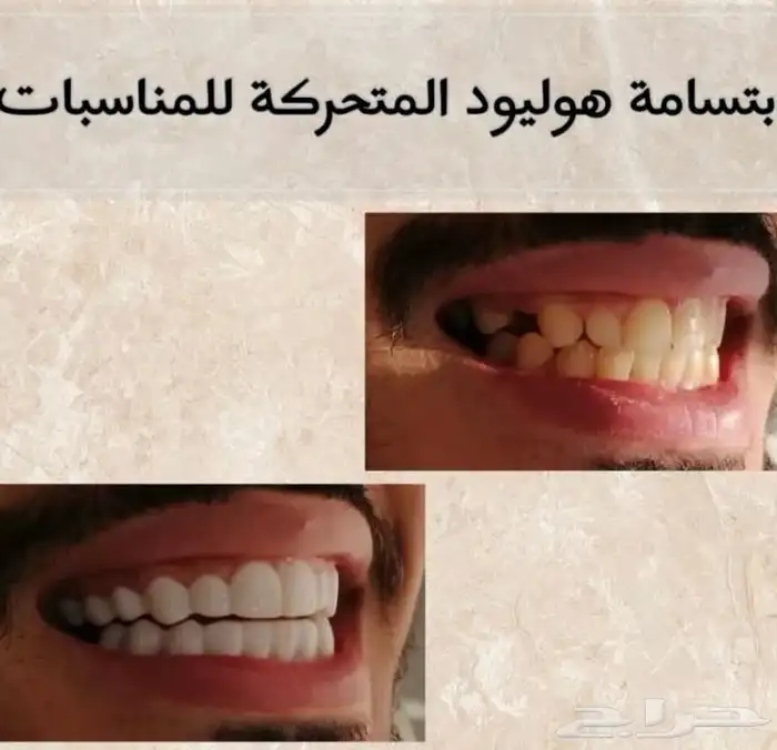 ابتسامة هوليوود المتحركة 5