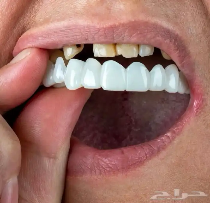ابتسامة هوليوود المتحركة 3