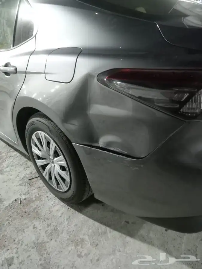 شفط وتعديل الصدمات بدون رش بويه 9