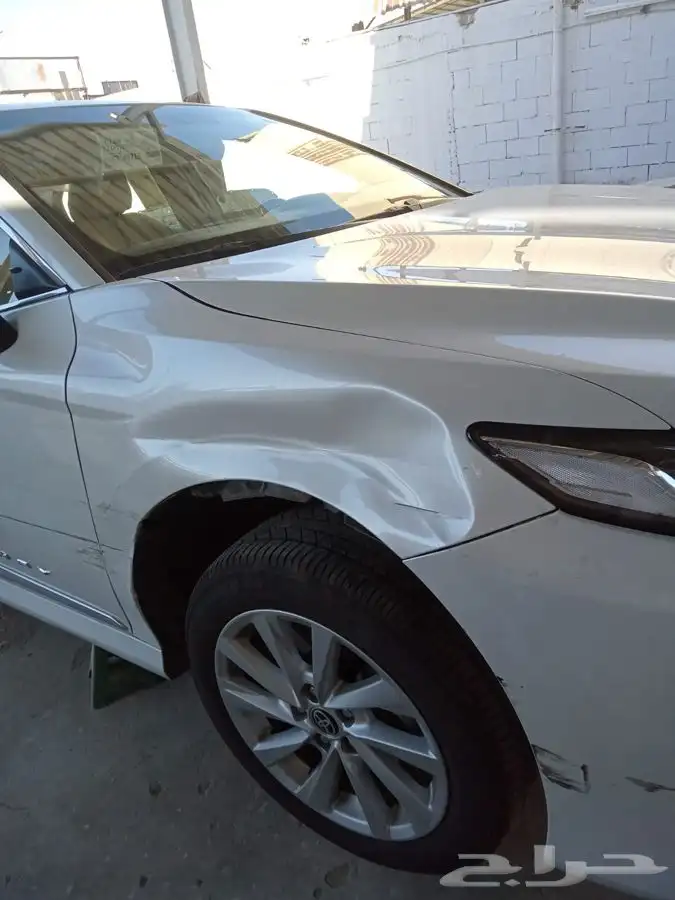 شفط وتعديل الصدمات بدون رش بويه 3