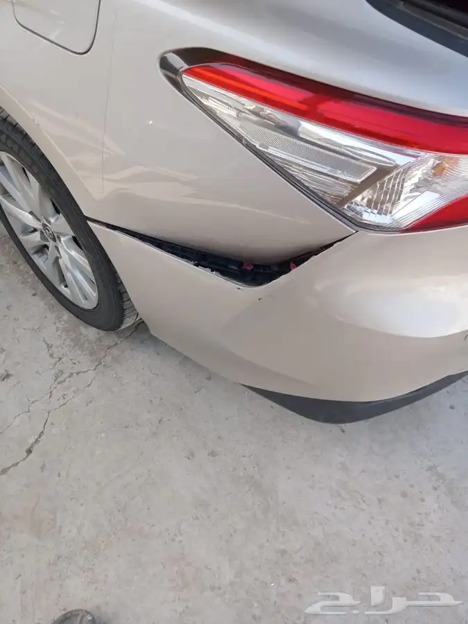 شفط وتعديل الصدمات بدون رش بويه 5