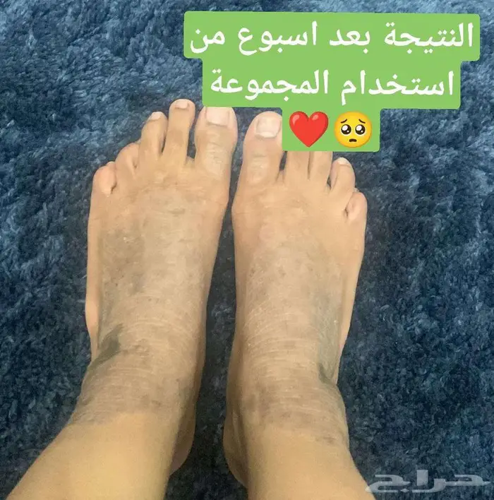 بوكس العناية الصحية من شركة فوريفر العالمية مع هدية بسيطة 90