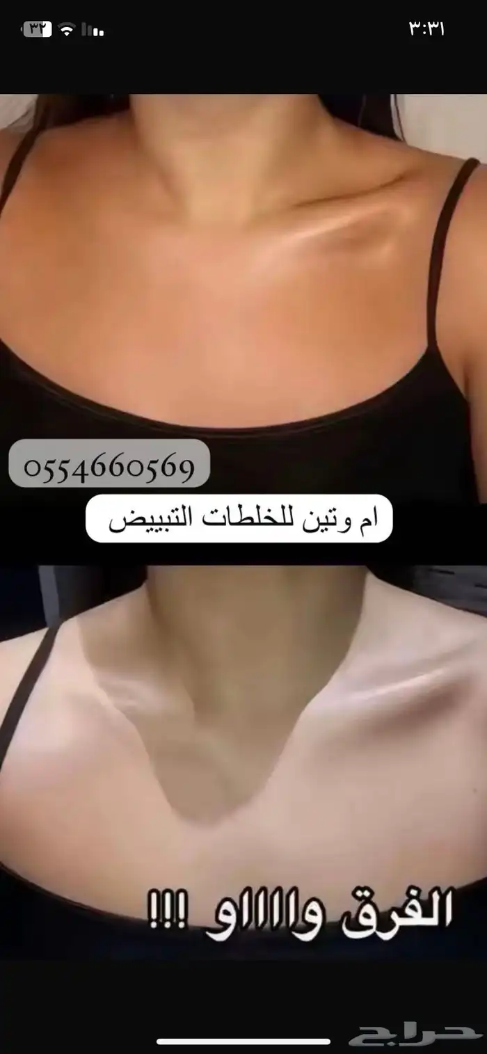 كريمات تبييض البشرة 2
