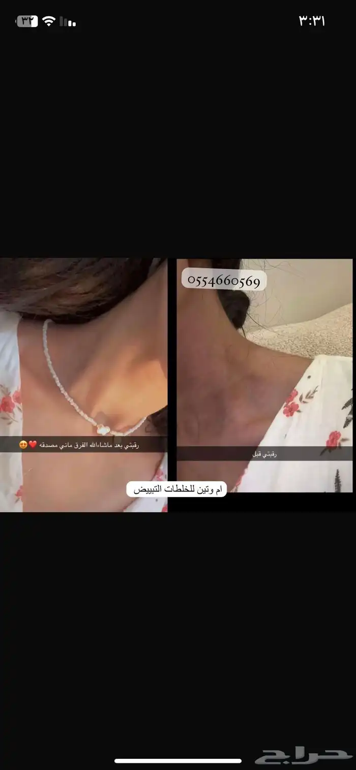 كريمات تبييض البشرة 0