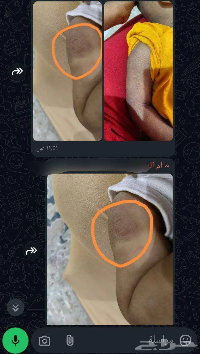 بوكس العناية من فوريفر ليفينج مصرحة من هيئة الغذاء والدواء 80