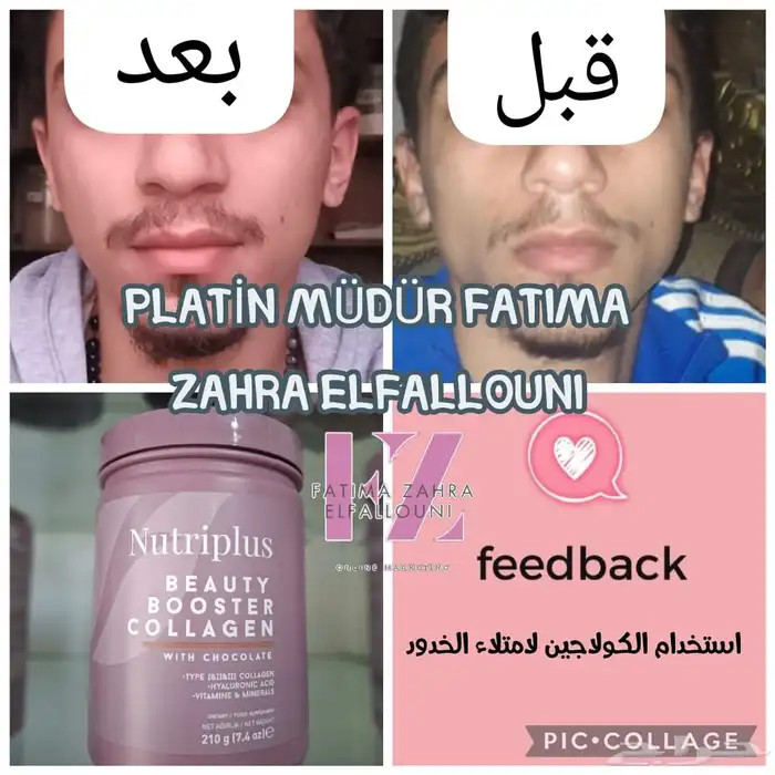 كولاجين بتايب 1 2 3 مع الهيالورنيك اسيد والفيتامينات 9