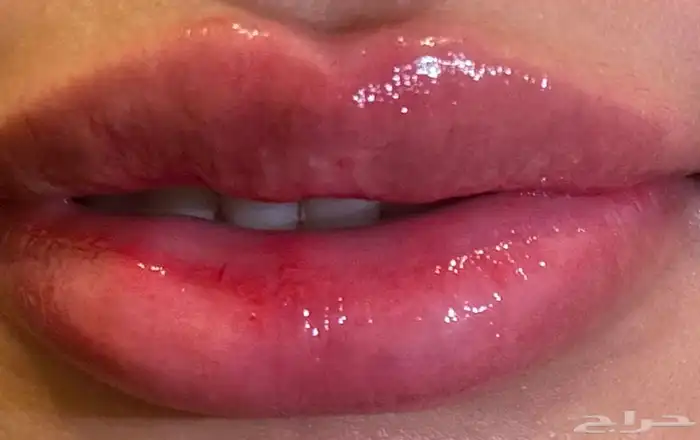 جلسة تفتيح وتوريد الشفايف وب الوان عض ويه طبيعيه 1