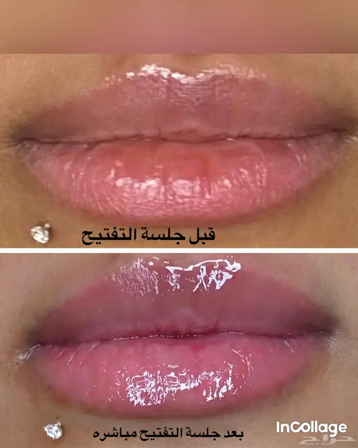 جلسة تفتيح وتوريد الشفايف وب الوان عض ويه طبيعيه 2