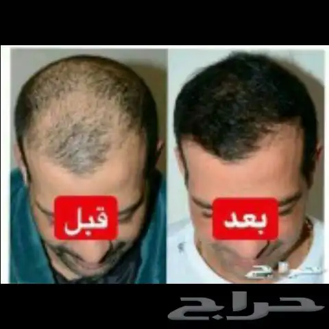 لماذا لا تستعد م فقد منك 0