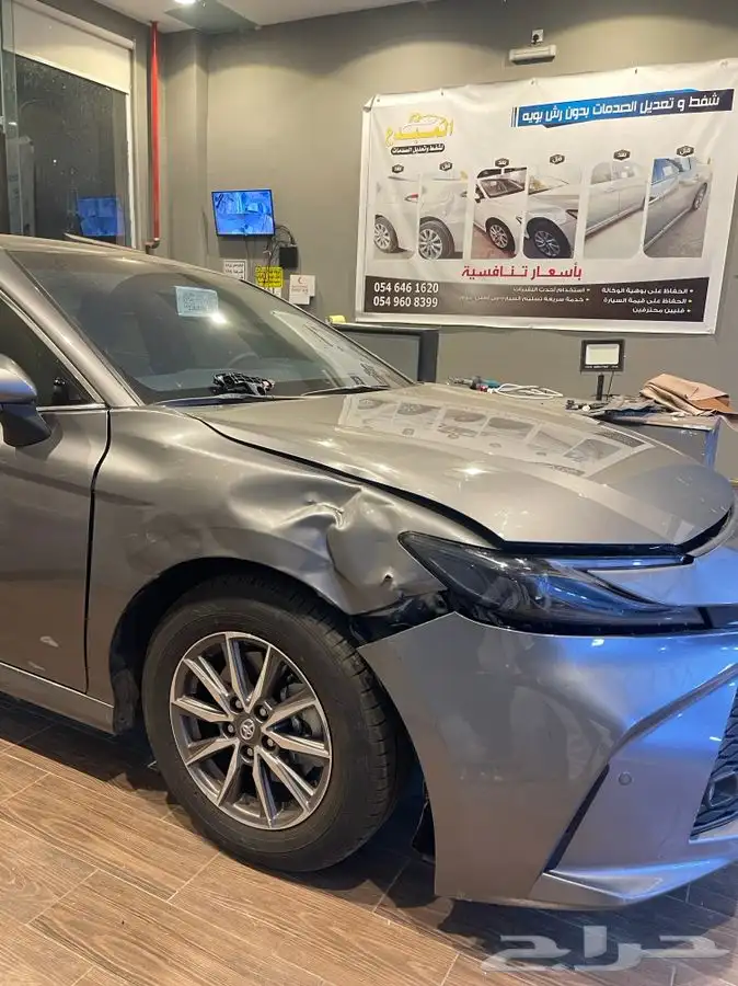 شفط وتعديل الصدمات بدون رش بويه 0