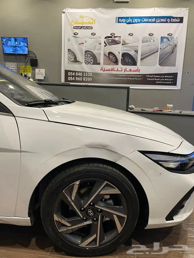 شفط وتعديل الصدمات بدون رش بويه 4