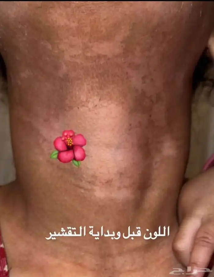 كريم بديل ابر التبيض 0