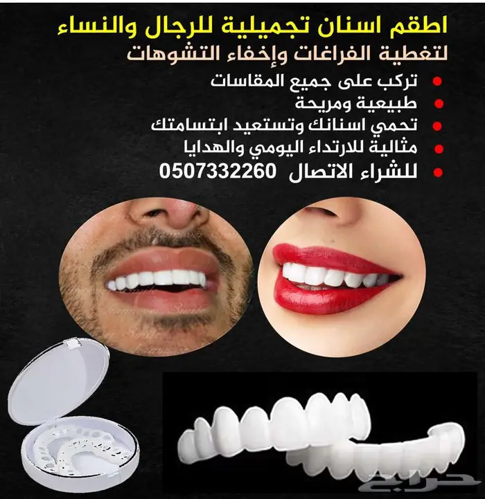 للبيع تلبيسات اسنان تجميلية 0